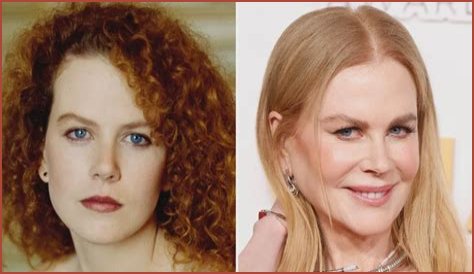 Nicole Kidman's 